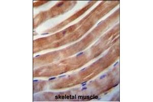 KE antibody (C-term) 0092b immunohistochemistry analysis in formalin fixed and paraffin embedded human skeletal muscle followed by peroxidase conjugation of the secondary antibody and DAB staining. (KEAP1 anticorps  (C-Term))