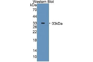 Western blot analysis of the recombinant protein. (Protein phosphatase 1 (AA 433-636), (Regulatory Subunit 15A) anticorps)