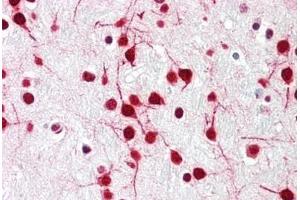 Human Brain, Cortex: Formalin-Fixed, Paraffin-Embedded (FFPE) (DELE1/KIAA0141 anticorps  (N-Term))