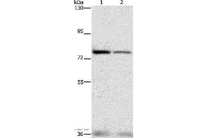 Western blot analysis of HepG2 and hela cell, using NFE2L1 Polyclonal Antibody at dilution of 1:280 (NFE2L1 anticorps)