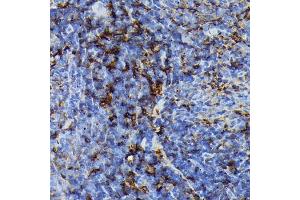 Immunohistochemistry of paraffin-embedded rat spleen using FADD Rabbit mAb (ABIN7267135) at dilution of 1:100 (40x lens).