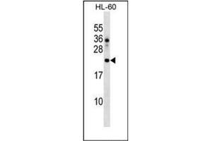 Western blot analysis of DPH4 Antibody  in HL-60 cell line lysates (35ug/lane). (DNAJC24 anticorps  (Middle Region))