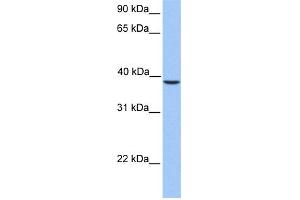 WB Suggested Anti-SUNC1 Antibody Titration: 0. (SUN3 anticorps  (C-Term))