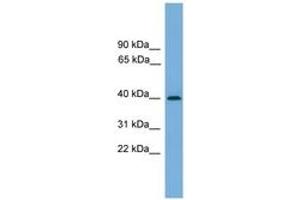 Image no. 1 for anti-serpin Peptidase Inhibitor, Clade B (Ovalbumin), Member 8 (SERPINB8) (AA 251-300) antibody (ABIN6745215)