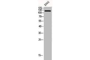 Western Blot analysis of K562 cells using COL2A1 Polyclonal Antibody