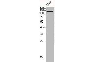 Western Blot analysis of K562 cells using COL2A1 Polyclonal Antibody (COL2A1 anticorps  (N-Term))