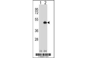 Western blot analysis of CYP20A1 using rabbit polyclonal CYP20A1 Antibody using 293 cell lysates (2 ug/lane) either nontransfected (Lane 1) or transiently transfected (Lane 2) with the CYP20A1 gene. (CYP20A1 anticorps  (AA 221-250))