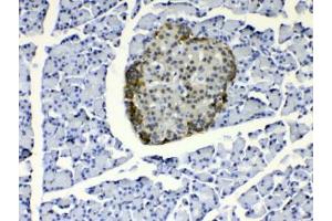 IHC testing of FFPE rat pancreas tissue with COPE antibody at 1ug/ml. (COPE anticorps)