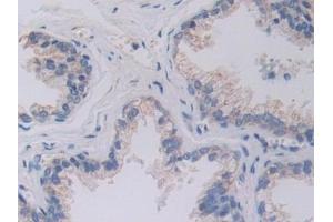 Detection of SHMT2 in Human Prostate Tissue using Polyclonal Antibody to Serine Hydroxymethyltransferase 2, Mitochondrial (SHMT2)