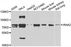 Western blot analysis of extracts of various cell lines, using IRAK2 antibody. (IRAK2 anticorps  (AA 1-270))