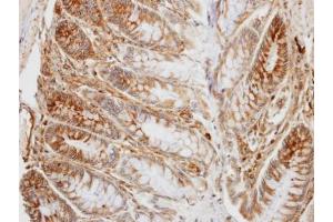 IHC-P Image Immunohistochemical analysis of paraffin-embedded human colon, using PD-L1, antibody at 1:100 dilution. (PD-L1 anticorps  (C-Term))