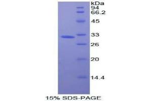 SDS-PAGE analysis of Human Oncostatin M Receptor Protein. (Oncostatin M Receptor Protein (OSMR))