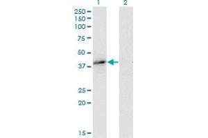 Western Blot analysis of MAPRE2 expression in transfected 293T cell line by MAPRE2 monoclonal antibody (M03), clone 4D7.