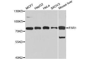 Western blot analysis of extracts of various cell lines, using ESR1 antibody. (Estrogen Receptor alpha anticorps  (AA 1-190))