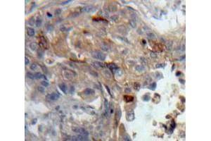 Used in DAB staining on fromalin fixed paraffin-embedded Lung tissue (PKC theta anticorps  (AA 380-634))