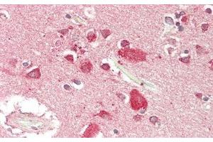 Detection of GFRa1 in Human Cerebrum Tissue using Polyclonal Antibody to Glial Cell Line Derived Neurotrophic Factor Receptor Alpha 1 (GFRa1)