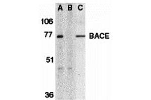 Western Blotting (WB) image for anti-Beta-secretase 1 (BACE1) (C-Term) antibody (ABIN1030276) (BACE1 anticorps  (C-Term))