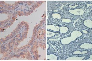 Immunohistochemistry of mouse Anti-AKT pS473 (MOUSE) Biotin Conjugated  at 40X Tissue: prostate Fixation: FFPE buffered formalin 10% conc Antigen retrieval: Heat, Citrate pH 6.
