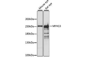 Western blot analysis of extracts of various cell lines, using MYH13 antibody. (MYH13 anticorps)