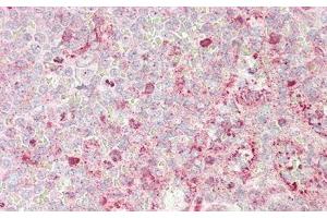 Detection of SOD3 in Human Spleen Tissue using Polyclonal Antibody to Superoxide Dismutase 3, Extracellular (SOD3)