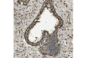 IHC analysis of RPA32/RPA2 using anti-RPA32/RPA2 antibody (ABIN7601380). (RPA2 anticorps  (AA 34-254))