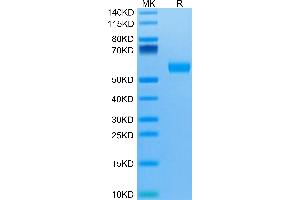 Biotinylated Human IL-5 R alpha/CD125 on Tris-Bis PAGE under reduced condition.