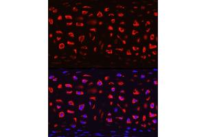 Immunofluorescence analysis of Rat cartilage using COMP Rabbit pAb (ABIN6127650, ABIN6138864, ABIN6138866 and ABIN6221502) at dilution of 1:200 (40x lens).