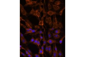 Immunofluorescence analysis of C6 cells using BRPF1 antibody (ABIN7265938) at dilution of 1:100. (BRPF1 anticorps  (AA 1-200))
