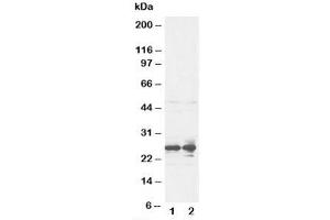 Western blot testing of FGF8 antibody and rat ovary tissue lysate (FGF8 anticorps  (C-Term))