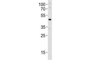 Western blot analysis of lysate from mouse pancreas tissue lysate using Pdx1 antibody at 1:1000. (PDX1 anticorps  (AA 136-169))