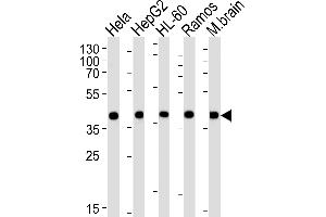 Western blot analysis of lysates from Hela, HepG2, HL-60, Ramos, mouse brain cell line (from left to right), using GOT2 Antibody (N-term) (ABIN652917 and ABIN2842590). (GOT2 anticorps  (N-Term))