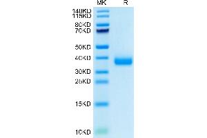 SARS-COV-2 Spike RBD (B.
