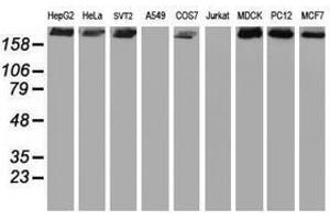 Image no. 4 for anti-Ubiquitin Specific Peptidase 9, X-Linked (USP9X) (AA 2246-2570) antibody (ABIN1491228) (USP9X anticorps  (AA 2246-2570))