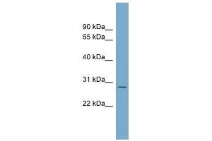C1ORF96 antibody used at 1 ug/ml to detect target protein. (CCSAP anticorps  (N-Term))