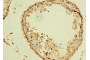 Immunohistochemistry of paraffin-embedded human testis tissue using ABIN7171826 at dilution of 1:100 (TSGA10 anticorps  (AA 1-200))
