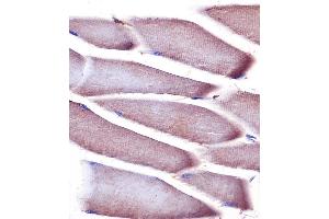 (ABIN6242694 and ABIN6578668) staining Vinculin in mouse skeletal muscle tissue sections by Immunohistochemistry (IHC-P - paraformaldehyde-fixed, paraffin-embedded sections).