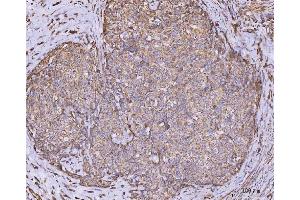 IHC analysis of CLASP1 using anti-CLASP1 antibody (ABIN7599144). (CLASP1 anticorps  (AA 1-243))