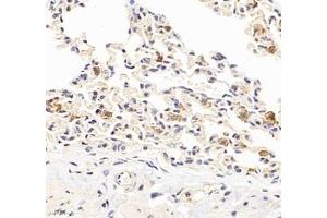 Immunohistochemistry of paraffin embedded rat lung using HSP70B (ABIN7074173) at dilution of 1: 1000 (400x lens)