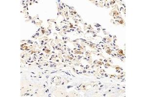 Immunohistochemistry of paraffin embedded rat lung using HSP70B (ABIN7074173) at dilution of 1: 1000 (400x lens) (HSPA6 anticorps)