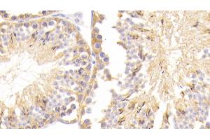Detection of UCHL1 in Mouse Testis Tissue using Polyclonal Antibody to Ubiquitin Carboxyl Terminal Hydrolase L1 (UCHL1)