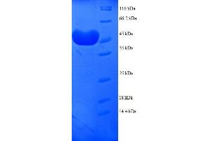 Proteasome (Prosome, Macropain) Subunit, alpha Type, 7 (PSMA7) (AA 5-232), (partial) protein (GST tag)