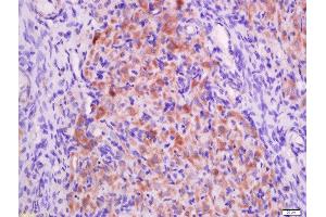 Paraformaldehyde-fixed, paraffin embedded rat ovary tissue, Antigen retrieval by boiling in sodium citrate buffer(pH6) for 15min, Block endogenous peroxidase by 3% hydrogen peroxide for 30 minutes, Blocking buffer (normal goat serum) at 37°C for 20min, Antibody incubation with Rabbit Anti-P2Y9 Polyclonal Antibody, Unconjugated  at 1:500 overnight at 4°C, followed by a conjugated secondary and DAB staining