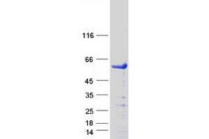 Validation with Western Blot (SMAD3 Protein (Transcript Variant 1) (Myc-DYKDDDDK Tag))