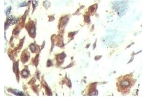 IHC testing of FFPE human breast tissue with ATF6 antibody at 5ug/ml. (ATF6 anticorps  (N-Term))