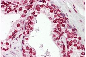 Anti-MKX antibody IHC staining of human prostate.