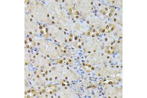 Immunohistochemistry of paraffin-embedded rat kidney using RPS27A antibody (ABIN7270022) at dilution of 1:100 (40x lens).