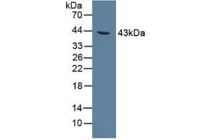 Detection of AGXT in Rat Liver Tissue using Polyclonal Antibody to Alanine Glyoxylate Aminotransferase (AGXT) (AGXT anticorps  (AA 182-371))