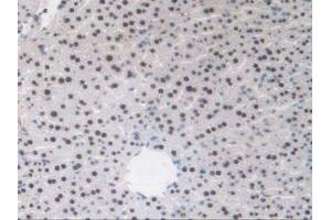 IHC-P analysis of Mouse Liver Tissue, with DAB staining. (TALDO1 anticorps  (AA 35-285))
