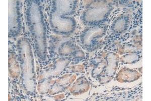 anti-DNA-Damage-Inducible Transcript 3 (DDIT3) (AA 1-169) antibody