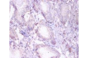 Immunohistochemistry of paraffin-embedded human prostate tissue using ABIN7173377 at dilution of 1:50